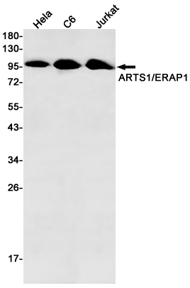 1 - ERAP1 Rabbit mAb AP75107