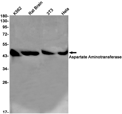 2 - Aspartate Aminotransferase Rabbit mAb AP75112