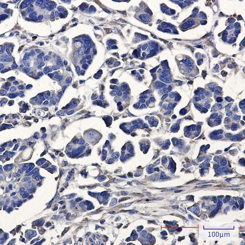 4 - [KO]ATE1 Rabbit mAb AP75115
