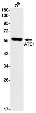 2 - [KO]ATE1 Rabbit mAb AP75115