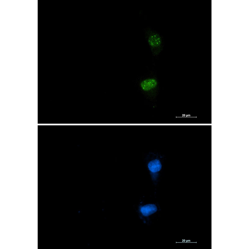 1 - Phospho-ATF2 (Thr71) Rabbit mAb AP75116