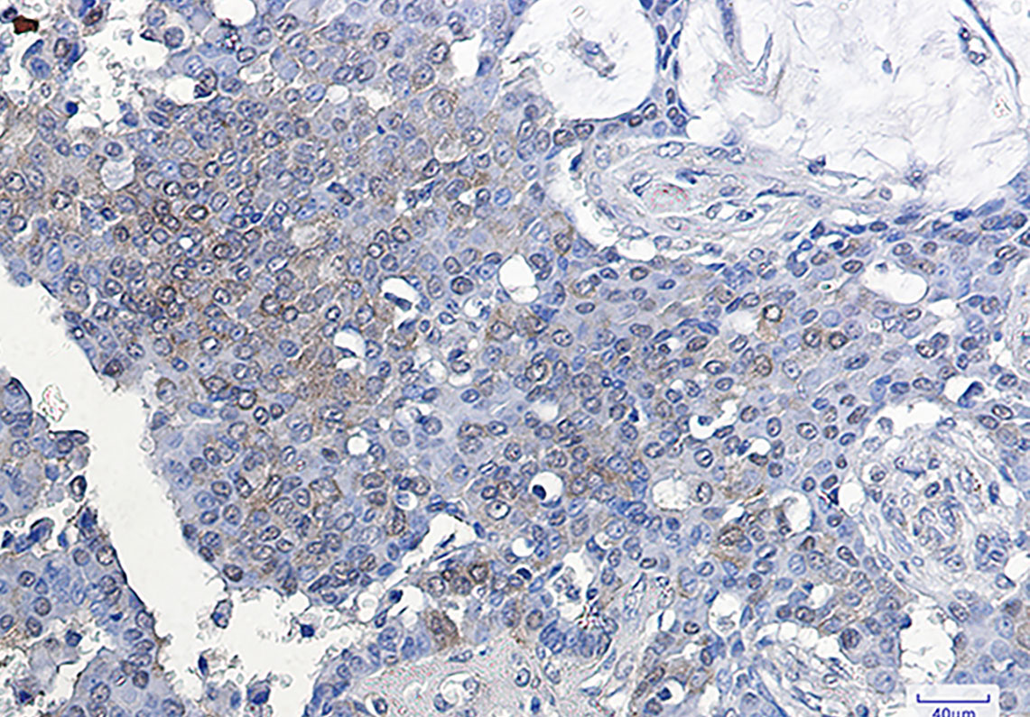 8 - ATF5 Rabbit mAb AP75117