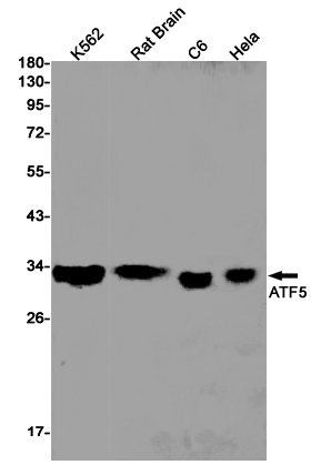2 - ATF5 Rabbit mAb AP75117