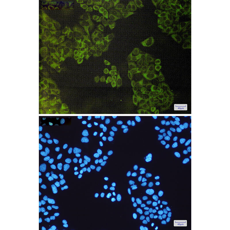 2 - ATG3 Rabbit mAb AP75119