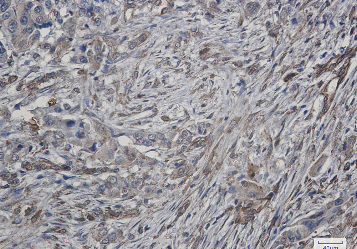 2 - ATG4C Rabbit mAb AP75121