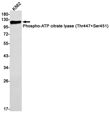 1 - Phospho-ATP Citrate Synthase (Thr447/Ser451) Rabbit mAb AP75123