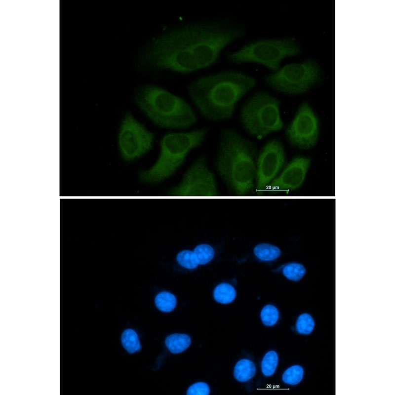 1 - ATP Citrate lyase Rabbit mAb AP75124