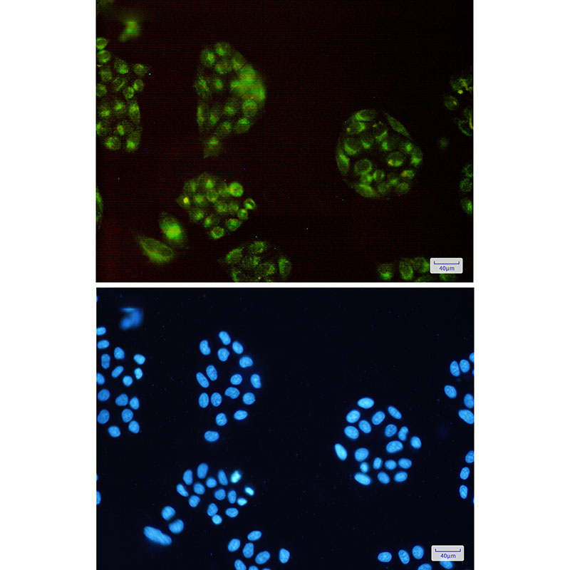 2 - ATP6V0D1/P39 Rabbit mAb AP75128