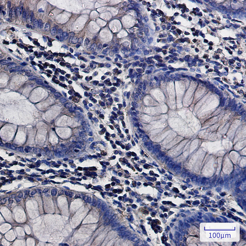 3 - ATP6V0D1/P39 Rabbit mAb AP75128