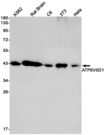 1 - ATP6V0D1/P39 Rabbit mAb AP75128