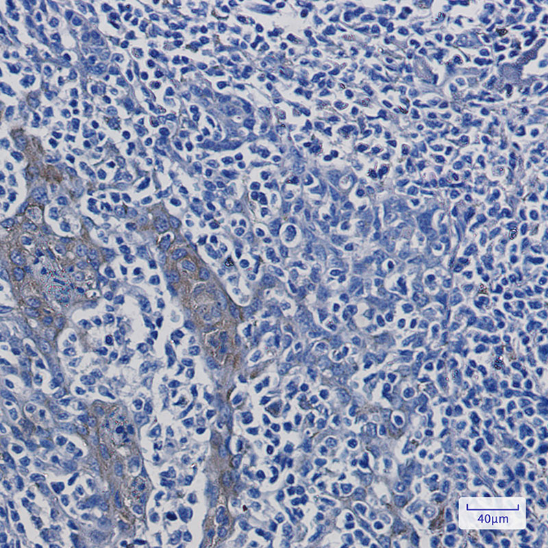 2 - ATP6V1A Rabbit mAb AP75129