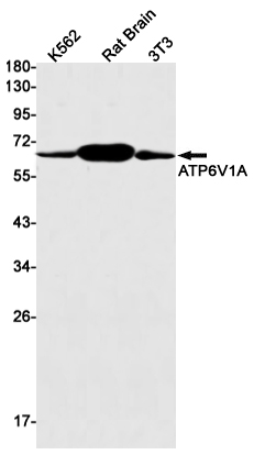 1 - ATP6V1A Rabbit mAb AP75129