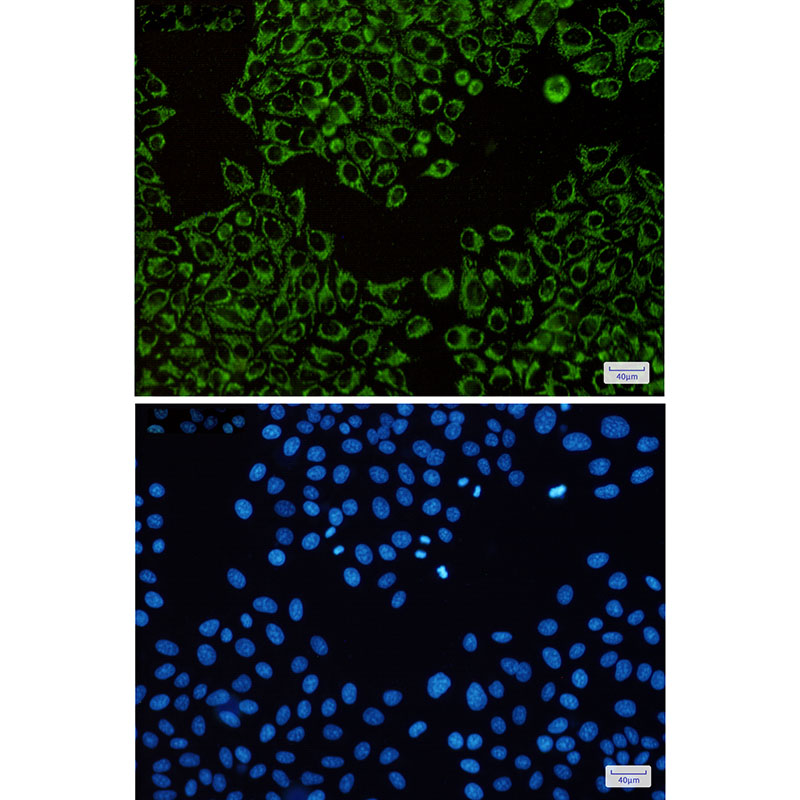 5 - ATPB Rabbit mAb AP75130