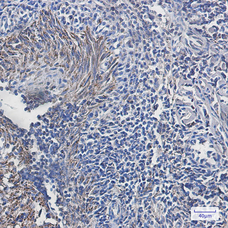 8 - ATPB Rabbit mAb AP75130