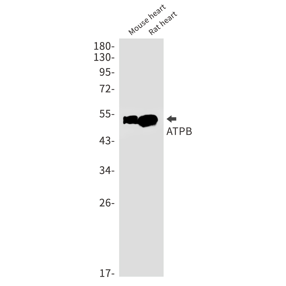 1 - ATPB Rabbit mAb AP75130