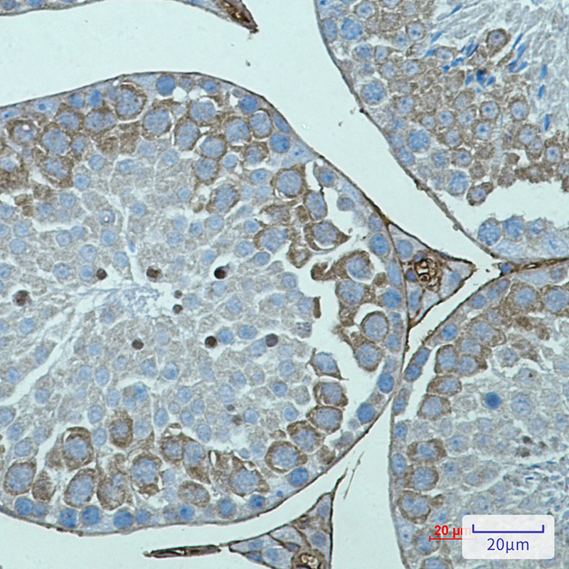 1 - AVEN Rabbit mAb AP75132