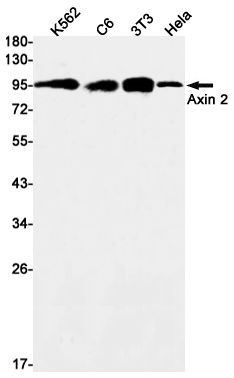 1 - Axin 2 Rabbit mAb AP75133