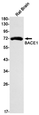 1 - BACE1 Rabbit mAb AP75137