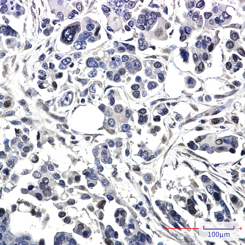 2 - BAG1 Rabbit mAb AP75139