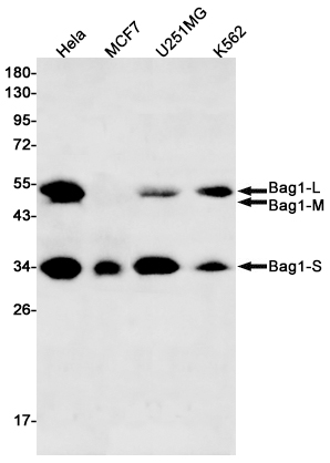 1 - BAG1 Rabbit mAb AP75139