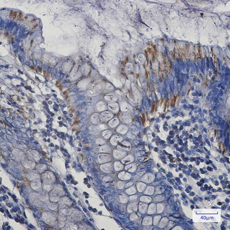 2 - Bak Rabbit mAb AP75143