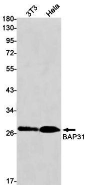 1 - BAP31 Rabbit mAb AP75145