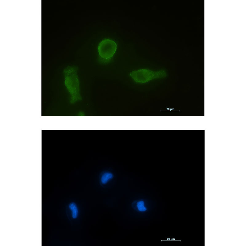 2 - [KO]Bcl-XL Rabbit mAb AP75150