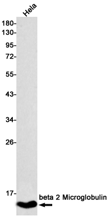 8 - beta 2 Microglobulin Rabbit mAb AP75151