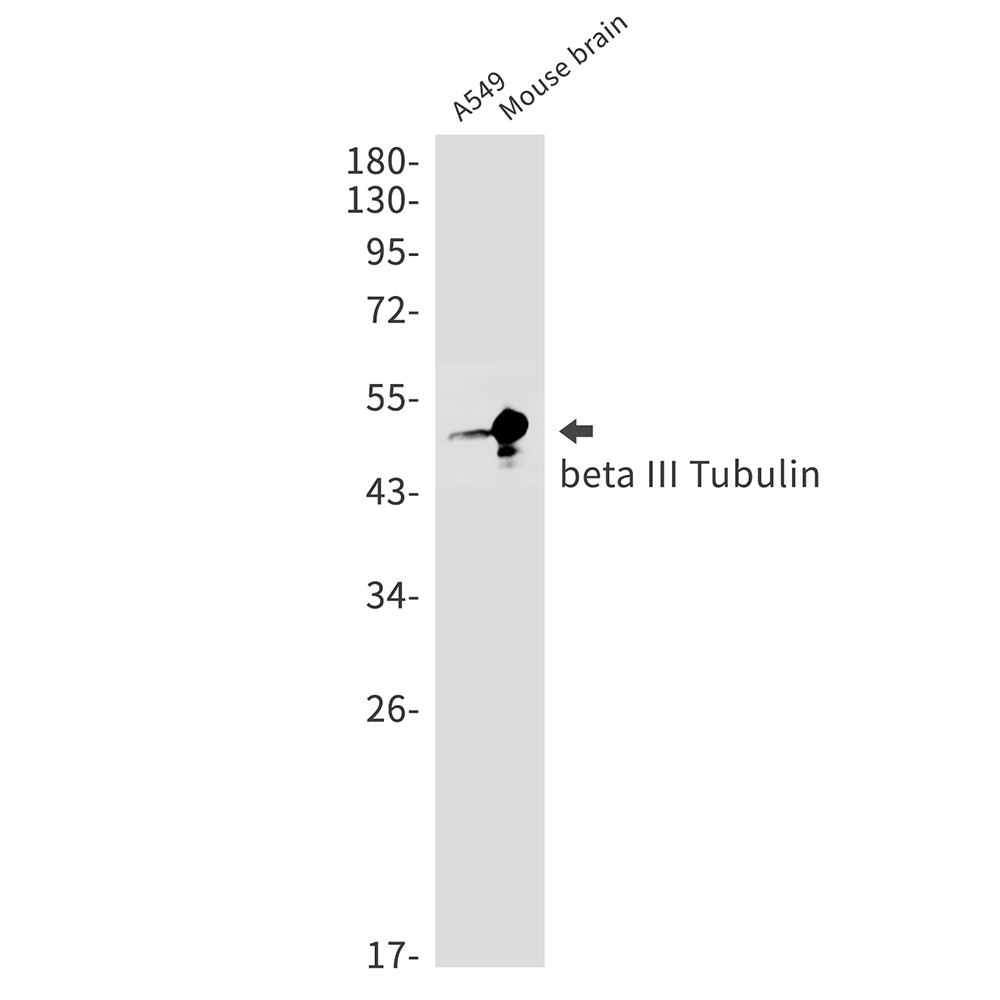 1 - beta III Tubulin Rabbit mAb AP75154