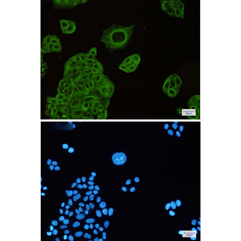 8 - beta IV Tubulin Rabbit mAb AP75155