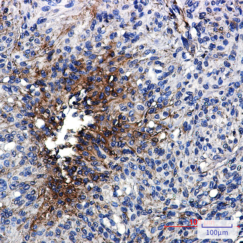 4 - beta IV Tubulin Rabbit mAb AP75155