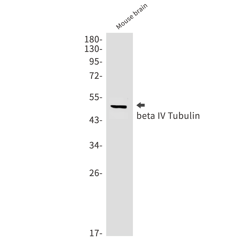 1 - beta IV Tubulin Rabbit mAb AP75155