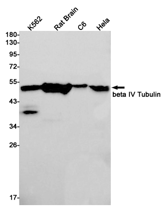 2 - beta IV Tubulin Rabbit mAb AP75155
