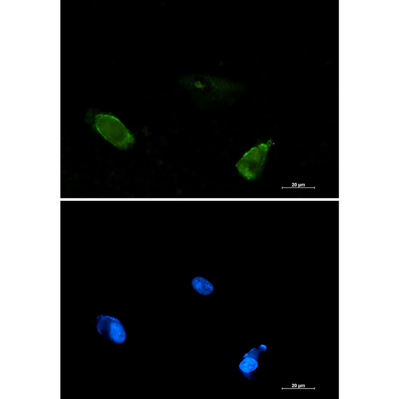 1 - BIN1 Rabbit mAb AP75157