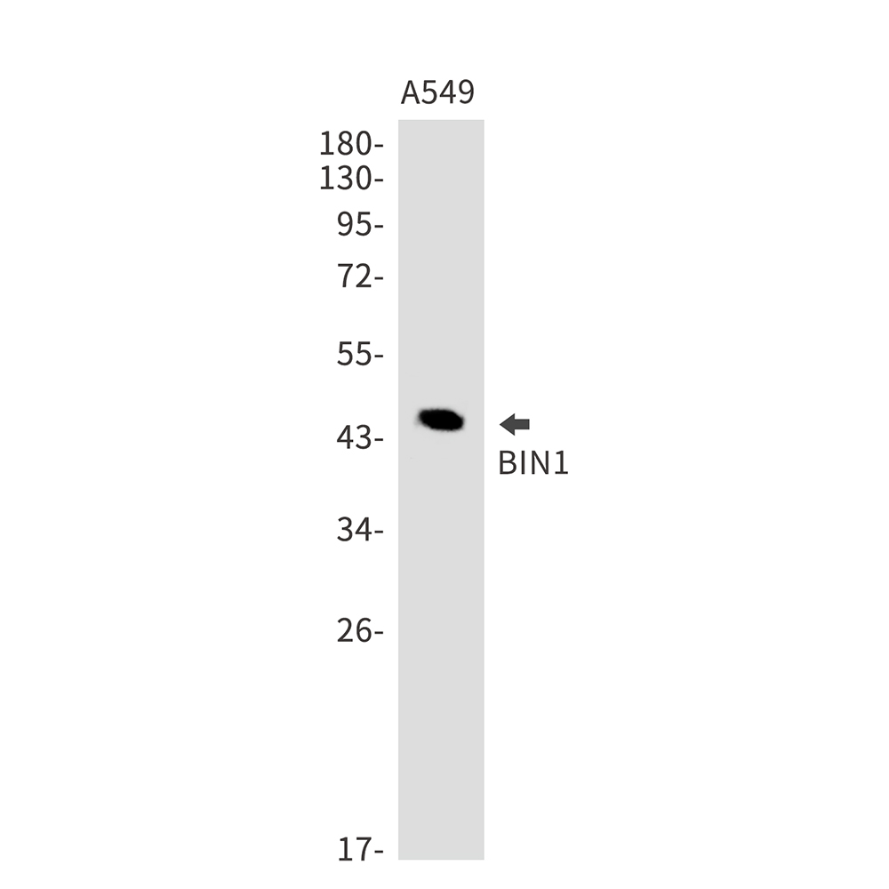 1 - BIN1 Rabbit mAb AP75158