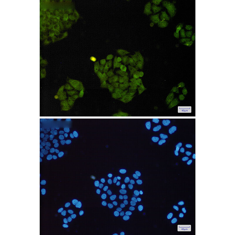 8 - BRAT1 Rabbit mAb AP75165