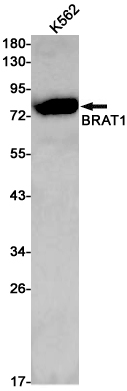 1 - BRAT1 Rabbit mAb AP75165