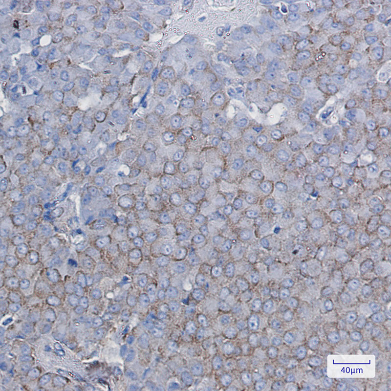 2 - [KO]BTF3 Rabbit mAb AP75170