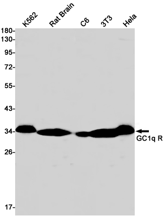 1 - GC1q R Rabbit mAb AP75172