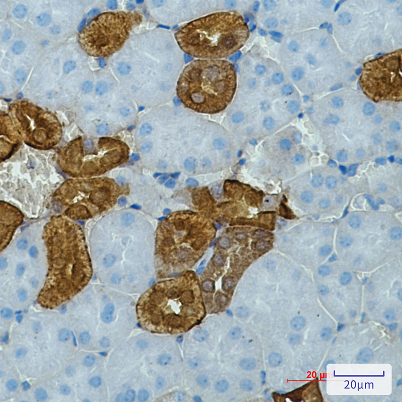 1 - Calbindin Rabbit mAb AP75178