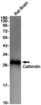 2 - Calbindin Rabbit mAb AP75178