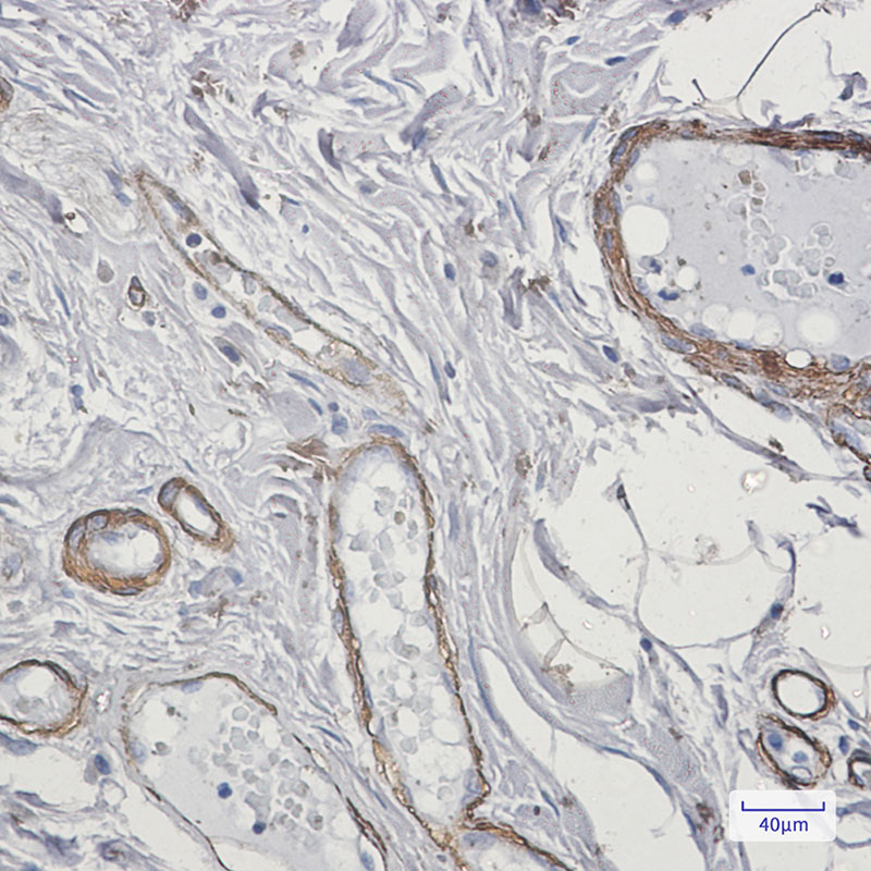 8 - [KO]Caldesmon/CDM Rabbit mAb AP75179