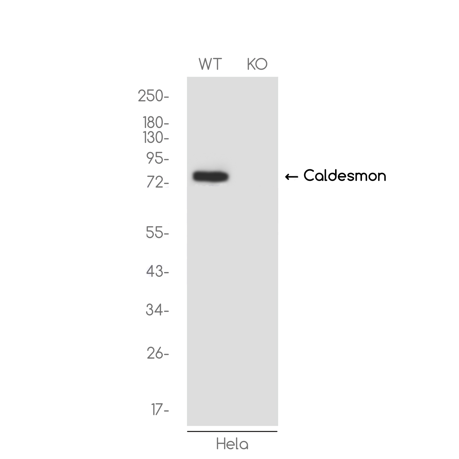 1 - [KO]Caldesmon/CDM Rabbit mAb AP75179