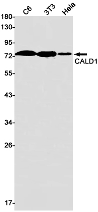 2 - [KO]Caldesmon/CDM Rabbit mAb AP75179