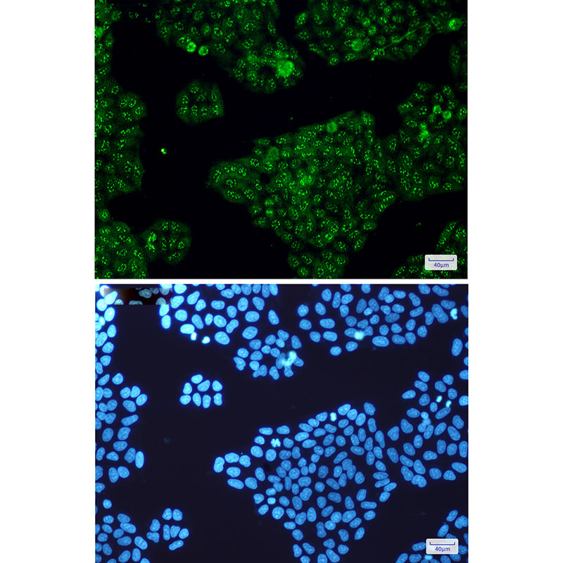 2 - Calretinin Rabbit mAb AP75181