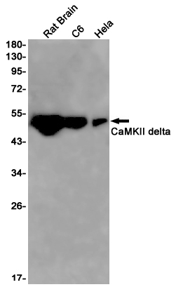 1 - CaMKII delta Rabbit mAb AP75182