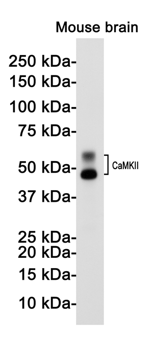 1 - CaMKII Rabbit mAb AP75184