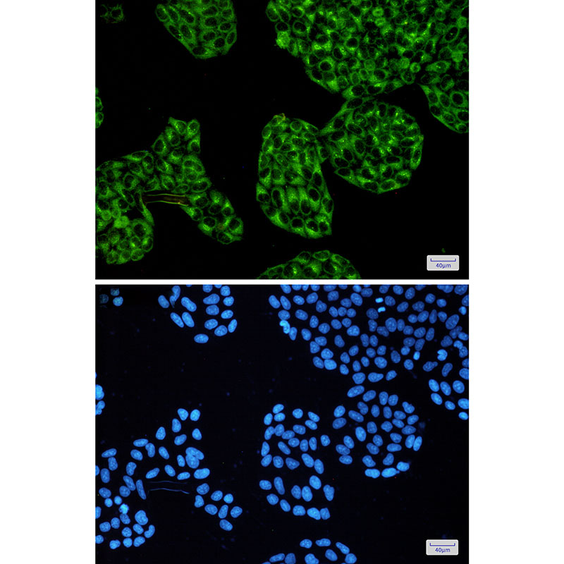 8 - [KD]cAMP Protein Kinase Catalytic Subunit Rabbit mAb AP75185