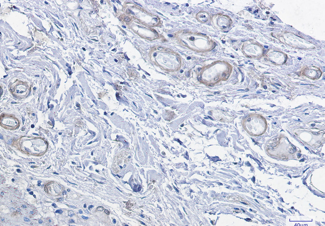 4 - [KD]cAMP Protein Kinase Catalytic Subunit Rabbit mAb AP75185