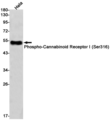 1 - Phospho-Cannabinoid Receptor I (Ser316) Rabbit mAb AP75186